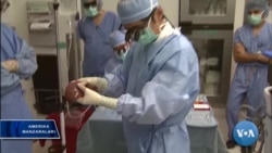 Jigar transplantatsiyasi: yangi jarrohlik usuli