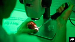 Investigadores españoles que esperan haber encontrado una pista para nuevos medicamentos contra el virus de la inmunodeficiencia humana (VIH por sus siglas en español).