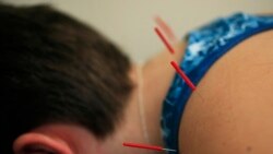 Quiz - US Health Agency Wants to Measure Pain