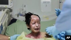 ด.ญ. ไรเซีย วัย 8 ขวบเหยื่อระเบิดฟอสฟอรัสขาวในอัฟกานิสถาน เมื่อราว 3 ปีก่อน (AP Photo/Rafiq Maqbool)