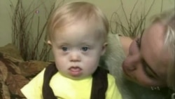 Phone App Could Help Detect Down Syndrome