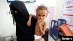 Mother of malnourished Ferial Elias, 2, holds her at a malnutrition treatment ward at al-Thawra hospital in Hodeida, Yemen, Nov. 3, 2018. 