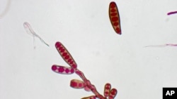 Hasil uji laboratorium menunjukkan jamur jenis Exserohilum rostratum mencemari sejumlah botol steroid dan menyebabkan kematian sedikitnya 20 orang di AS (foto: dok).